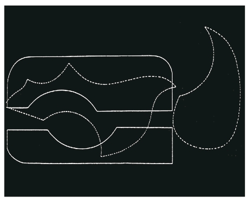 Pickguard (black)